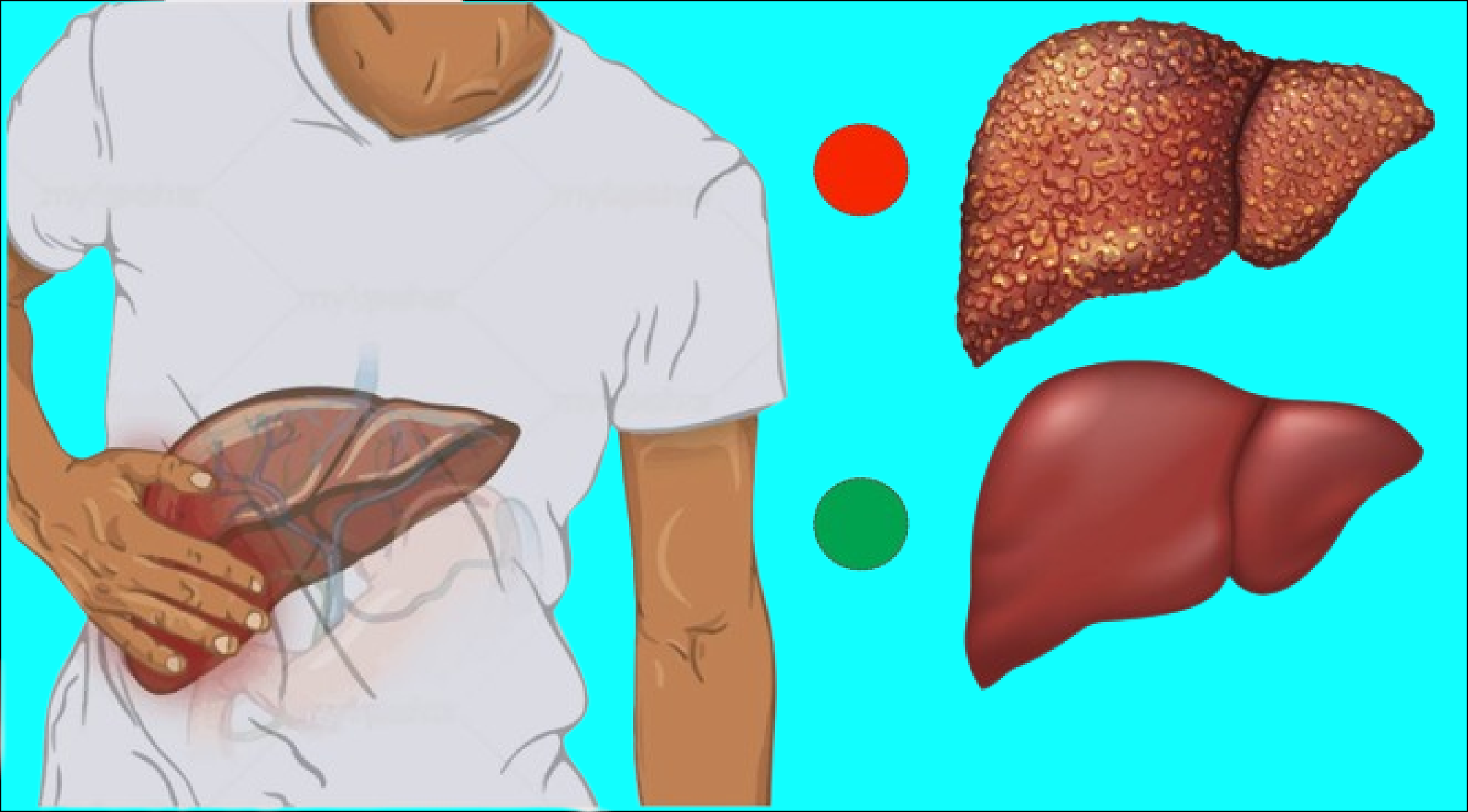 10 warning signs of liver damage that you should not ignore