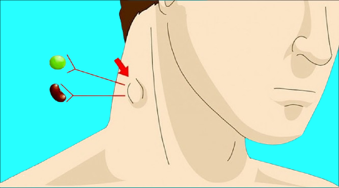 Do you have a lump on your neck, back, or behind your ear? Here is some important information