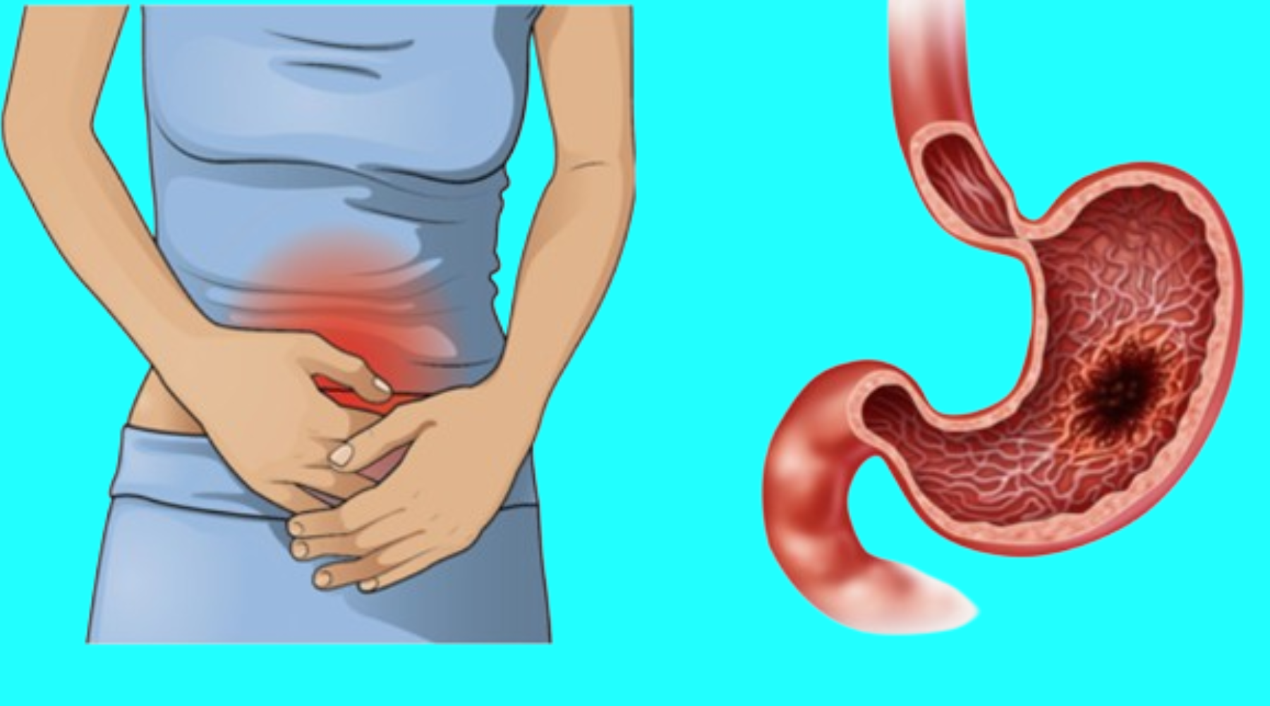 The Quiet Danger: Signs and manifestations of stomach cancer